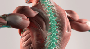 Carrolltown thoracic spine