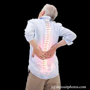 image Carrolltown back pain with lumbar spinal stenosis